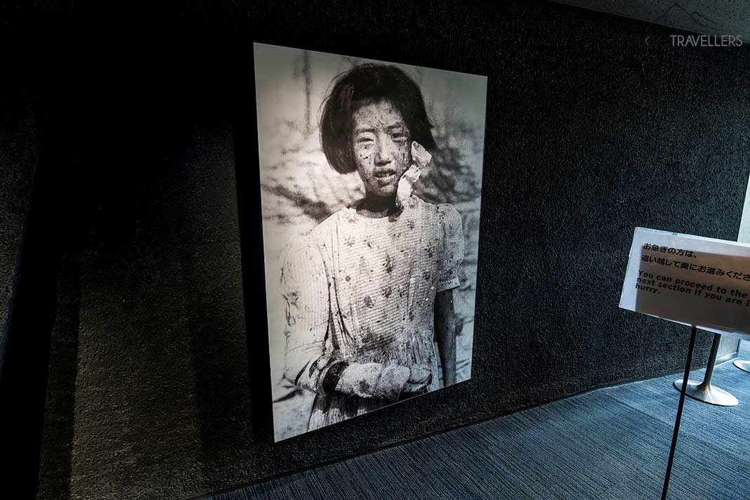Das Foto von Yukio Kunihira zeigt ein verletztes Mädchen nach dem Atombombenabwurf über Hiroshima